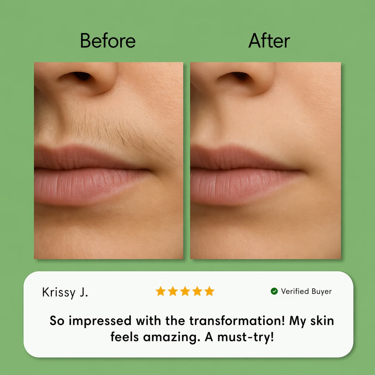 Hair Removal Trilogy Kit