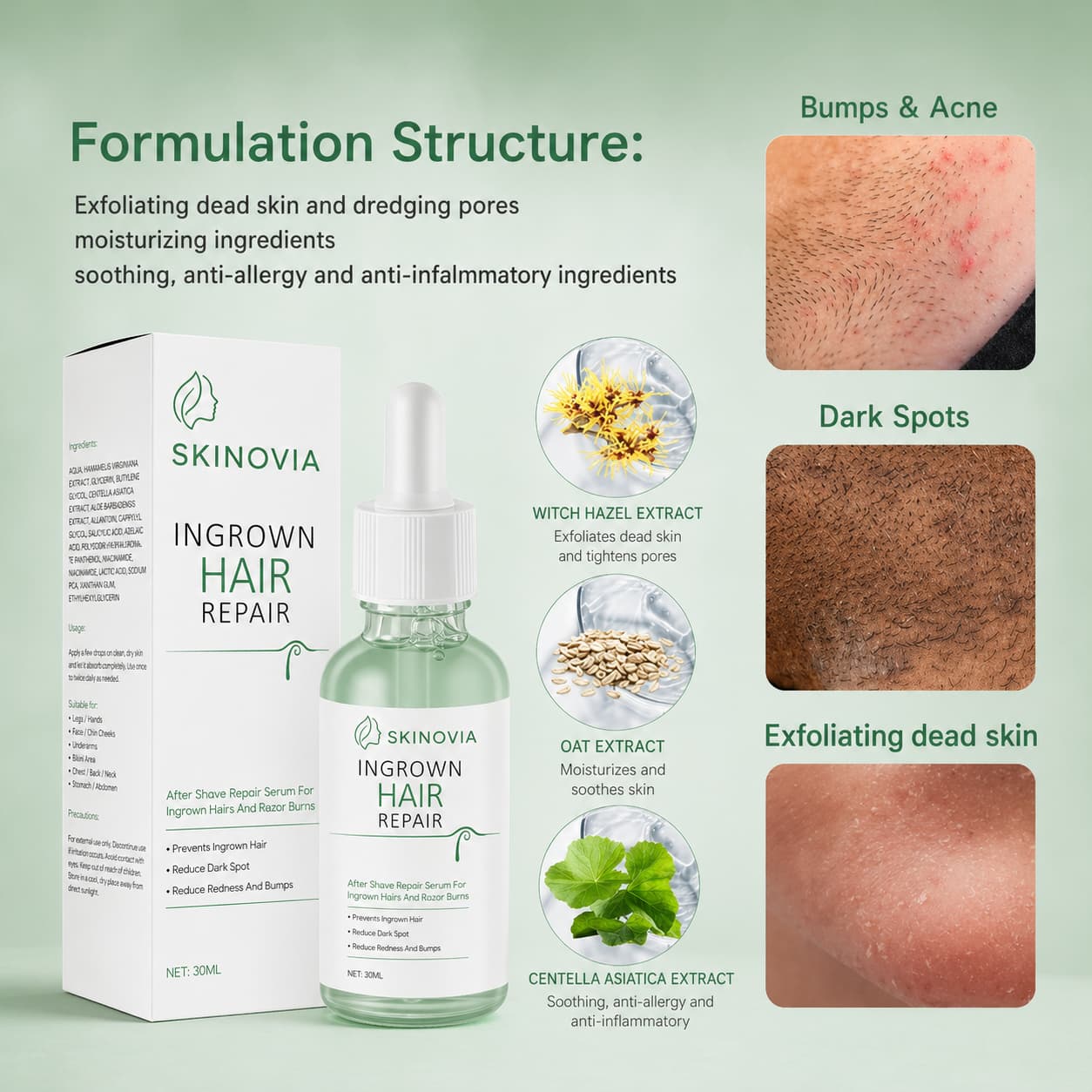Ingrown Hair Repair Serum