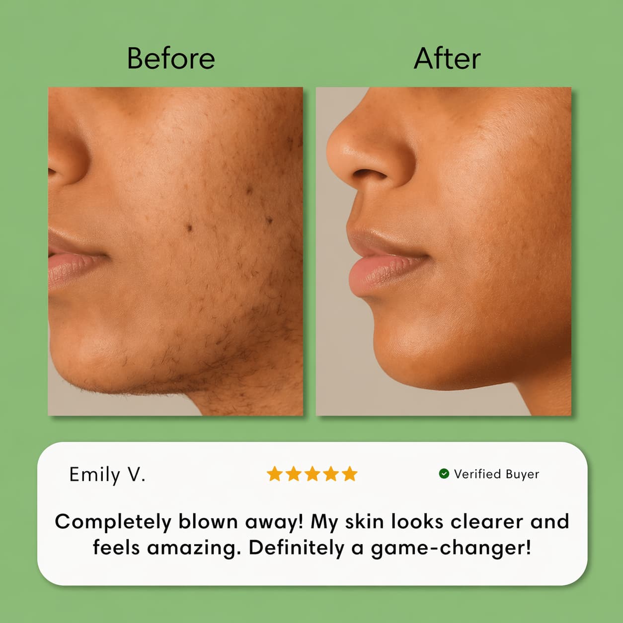 Hair Removal Trilogy Kit