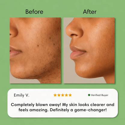 Hair Removal Trilogy Kit
