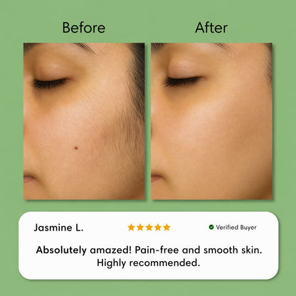 Hair Removal Trilogy Kit