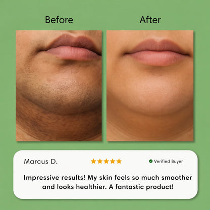 Hair Removal Trilogy Kit