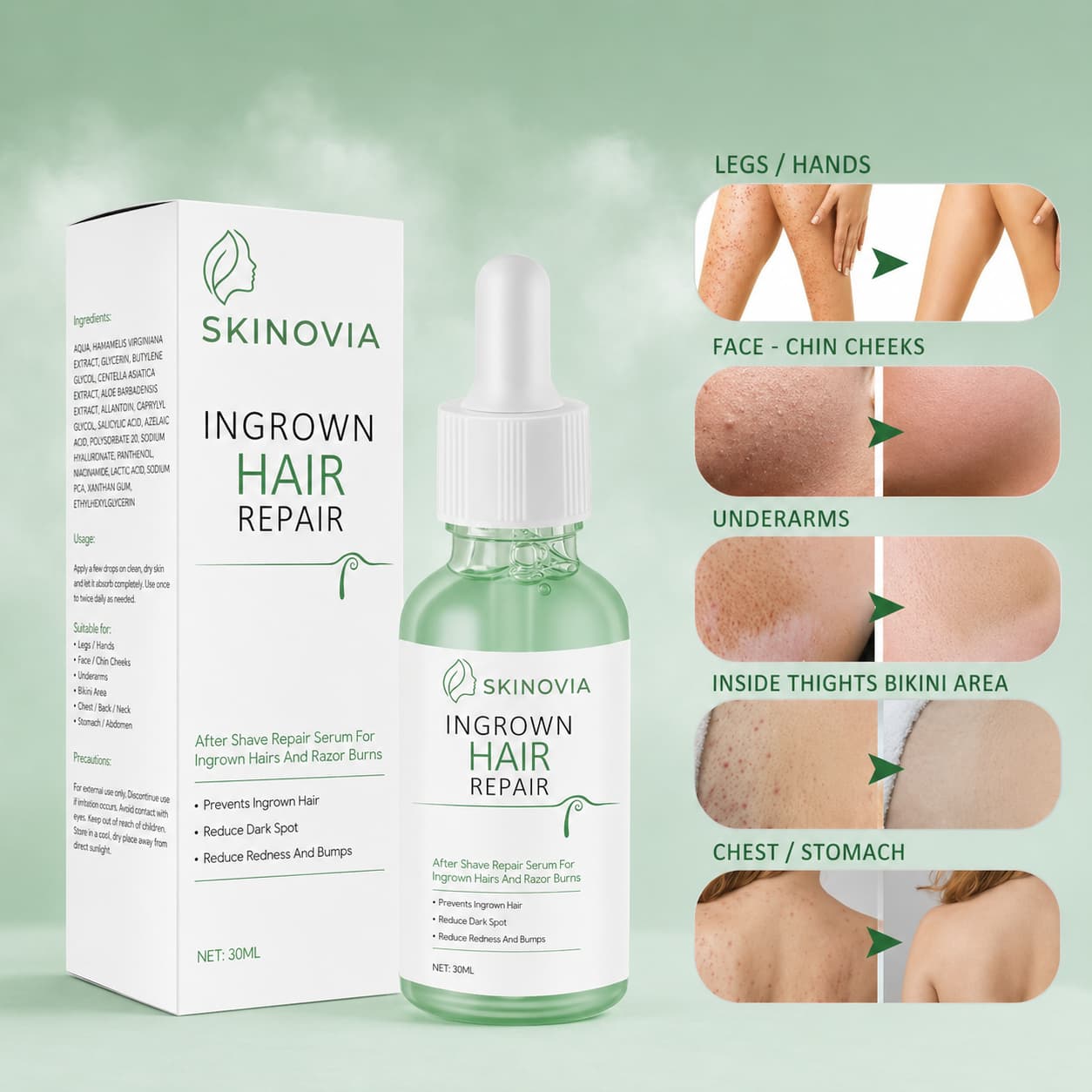 Ingrown Hair Repair Serum