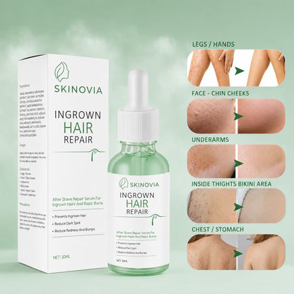 Ingrown Hair Repair Serum